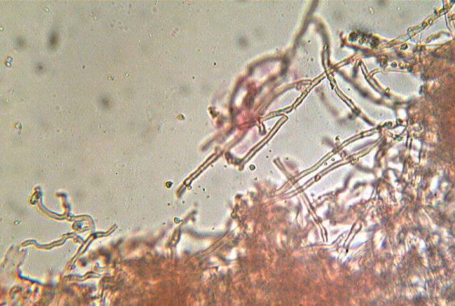 Hyphoderma sambuci
